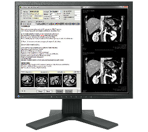 Монитор 19" Eizo Radiforce MX194 черный