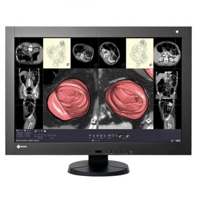 Монитор EIZO RadiForce 4MP 30" RX430-BK