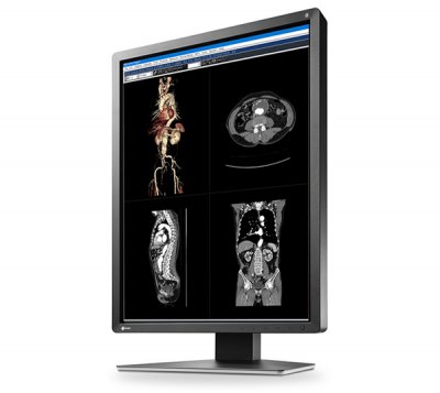 Монитор 21.3" EIZO RadiForce MX216 черный