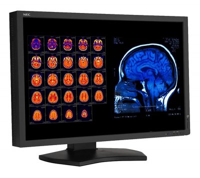 Монитор 29.8", 4МП NEC MD301C4, цветной 40000536