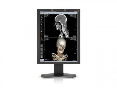 Монитор NEC MD211C2, 2МП, 21.3", цветной, LED 40000663
