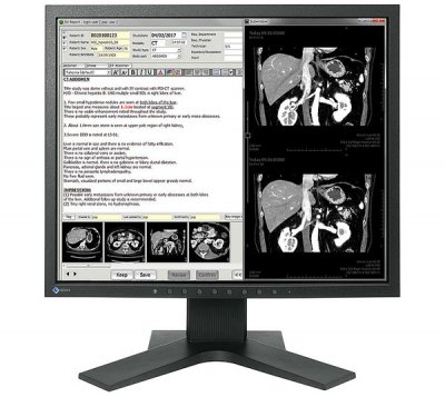 Монитор 19" Eizo Radiforce MX194 черный