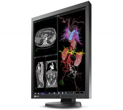 Монитор 21.3" EIZO RadiForce MX215 черный