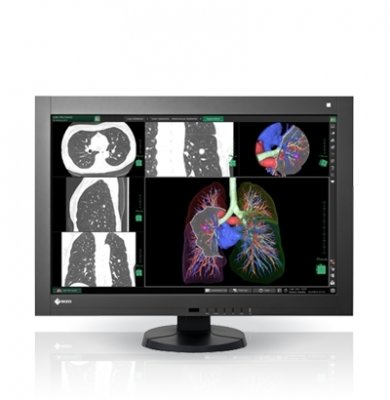 Монитор EIZO RadiForce 4MP, 29.8", цвет, DICOM, LED RX440